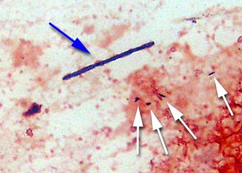 Il megabatterio ha una struttura allungata ( freccia blu ) - Flora batterica sullo sfondo ( frecce bianche ). Tampone cloacale, colorazione Gram ( Foto: Universit della Georgia )